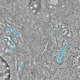 Illustration for article titled This Is What HIV Looks Like When It Infects Living Cells